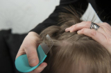 Head Lice At School: A Common Problem Solved – 13 Smart Tips